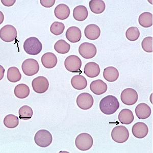 hemoplasmas
