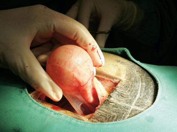 3. cirugía tortuga
