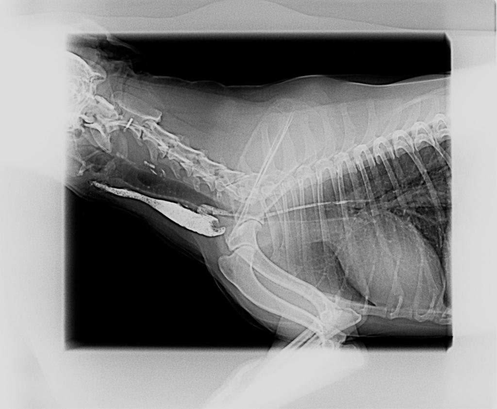 Imagen radiográfica de la estenosis esofágica