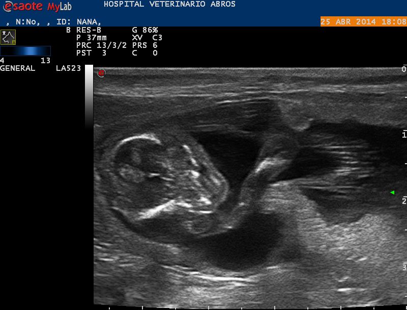 En esta imagen vemos la cabeza y extremidad anterior de un feto