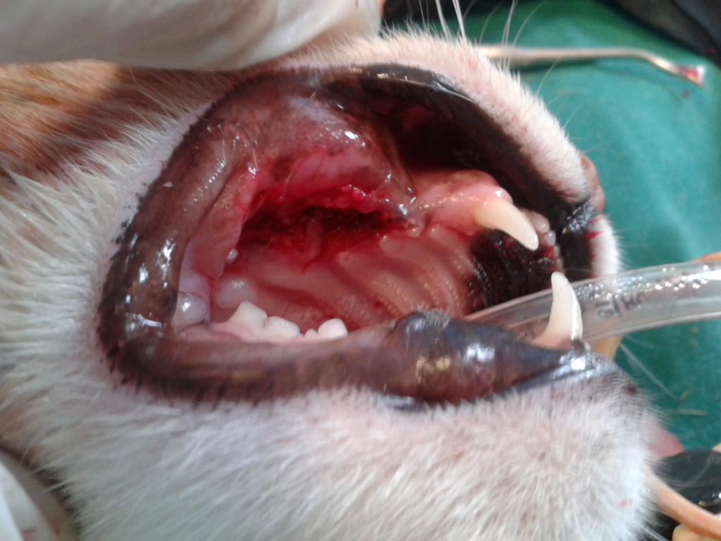 Extracción dentales