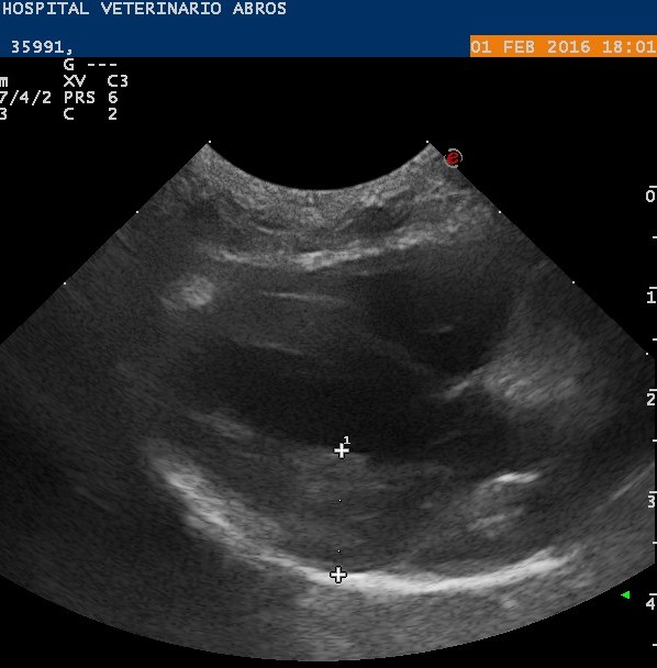 En la imagen ecográfica se puede observar entre las marcas, el tiroides, de un tamaño mayor del normal